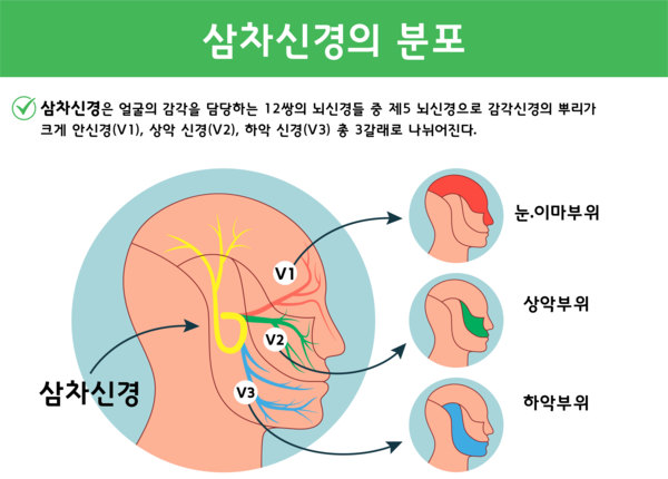 삼차신경통증상 찌릿한 아픔있다면 4